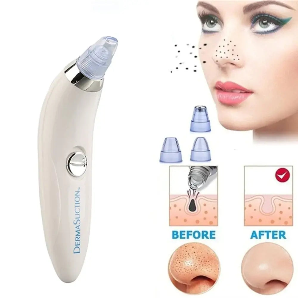 Derma Suction – Vakuum aparat za uklanjanje akni i mitisera